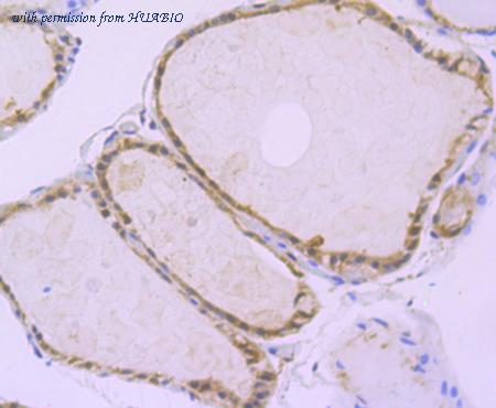 HUABIO ET1706-29 image 3