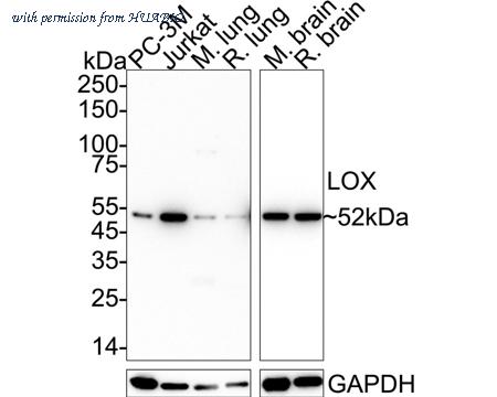 HUABIO ET1706-31 image 1