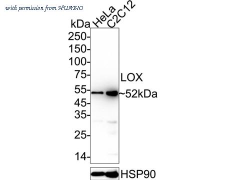 HUABIO ET1706-31 image 2