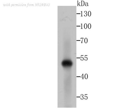 HUABIO ET1706-31 image 3