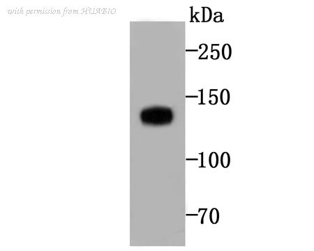 HUABIO ET1706-32 image 1