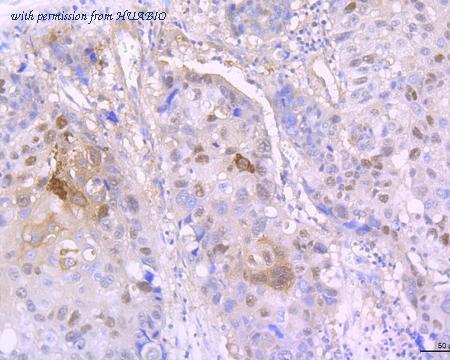 HUABIO ET1706-32 image 2