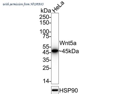 HUABIO ET1706-33 image 1