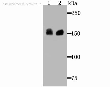 HUABIO ET1706-34 image 1