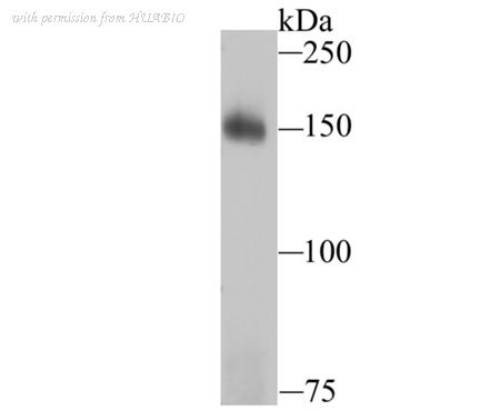 HUABIO ET1706-34 image 2