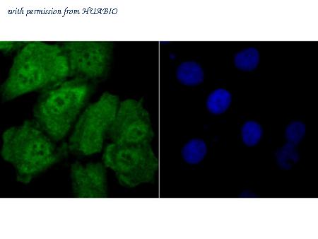HUABIO ET1706-34 image 3