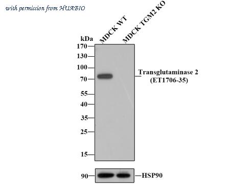 HUABIO ET1706-35 image 1