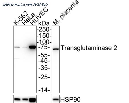 HUABIO ET1706-35 image 2