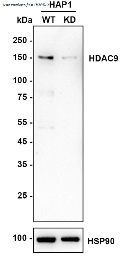 HUABIO ET1706-36 image 2