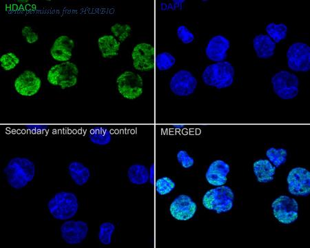 HUABIO ET1706-36 image 3