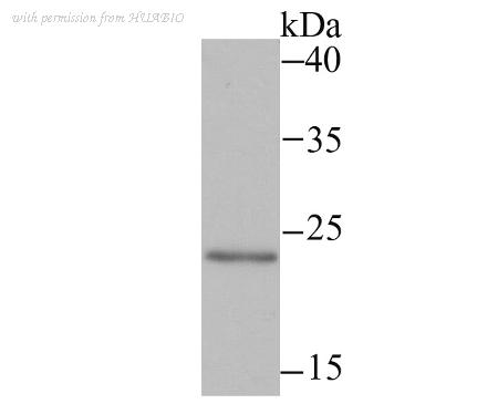 HUABIO ET1706-38 image 1