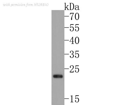 HUABIO ET1706-38 image 2