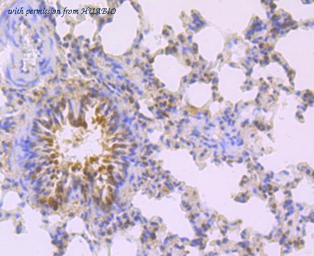 HUABIO ET1706-38 image 3