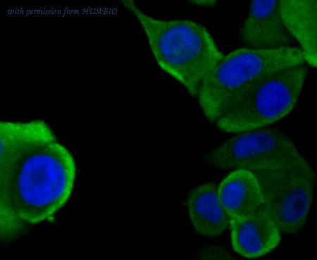 HUABIO ET1706-39 image 2