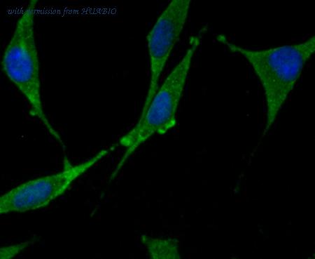 HUABIO ET1706-39 image 3