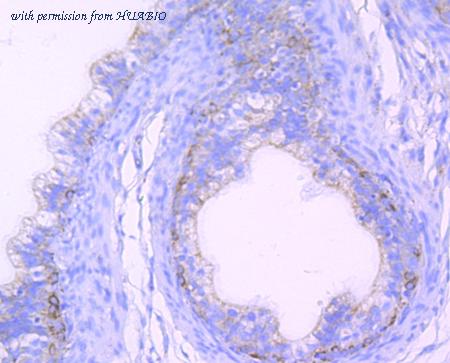 HUABIO ET1706-40 image 3