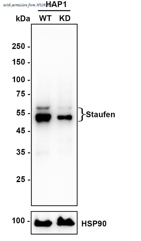 HUABIO ET1706-41 image 1