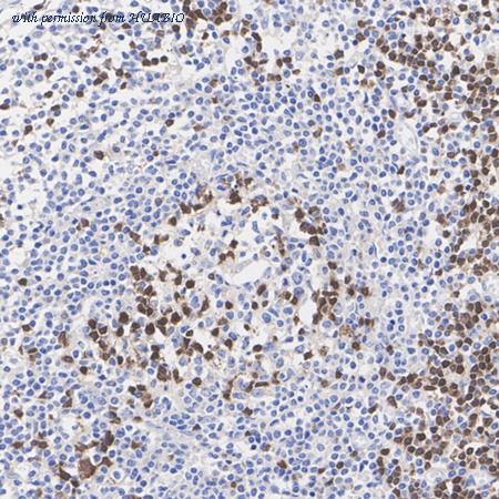 HUABIO ET1706-42 image 2