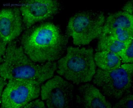 HUABIO ET1706-43 image 3