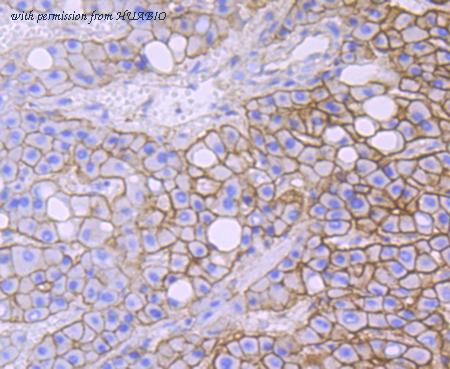 HUABIO ET1706-44 image 2