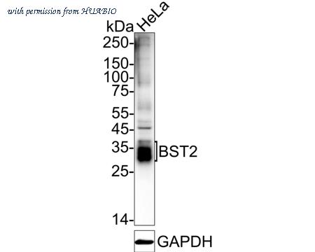 HUABIO ET1706-46 image 1