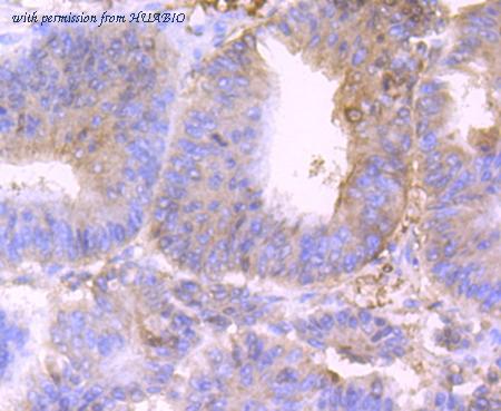 HUABIO ET1706-46 image 2