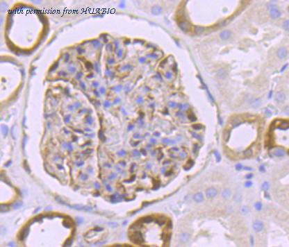 HUABIO ET1706-46 image 3