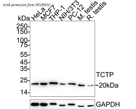 HUABIO ET1706-48 image 1