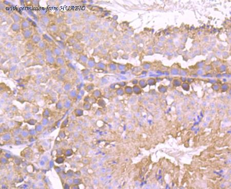 HUABIO ET1706-48 image 3