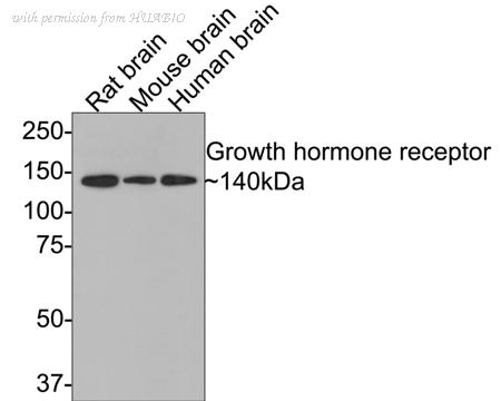 HUABIO ET1706-49 image 1