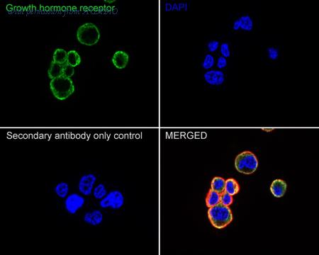 HUABIO ET1706-49 image 2