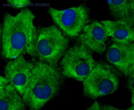 HUABIO ET1706-49 image 3