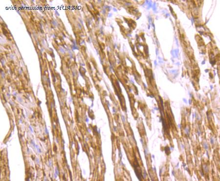 HUABIO ET1706-50 image 3