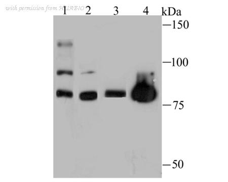 HUABIO ET1706-52 image 1