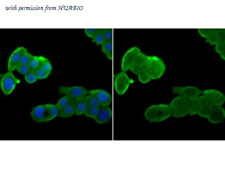 HUABIO ET1706-52 image 3