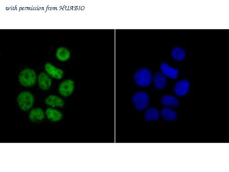 HUABIO ET1706-54 image 3