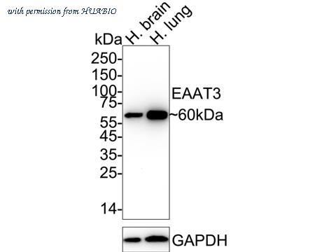 HUABIO ET1706-55 image 1