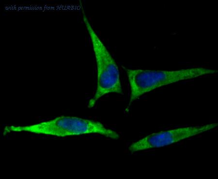 HUABIO ET1706-55 image 2