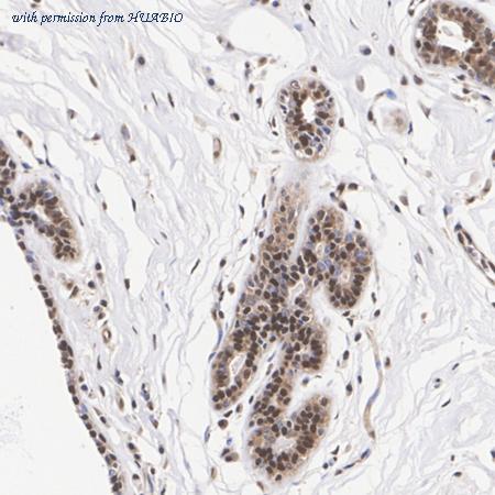 HUABIO ET7106-56 image 2