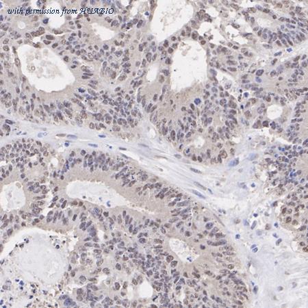 HUABIO ET7106-56 image 3