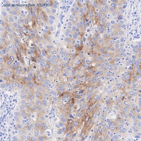 HUABIO ET7106-63 image 2