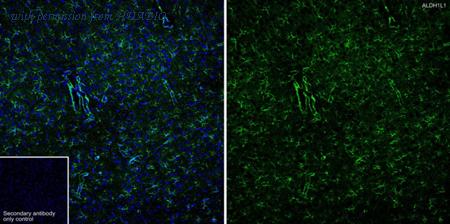 HUABIO ET7106-64 image 1