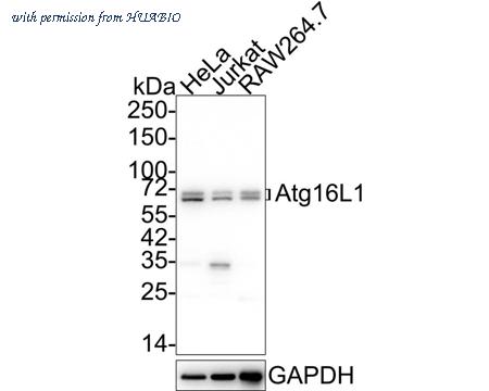 HUABIO ET7106-65 image 1