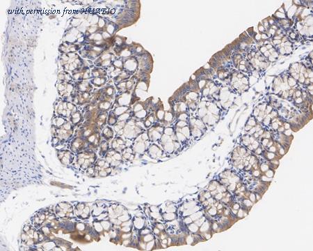 HUABIO ET7106-65 image 2