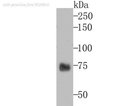 HUABIO ET7106-66 image 1