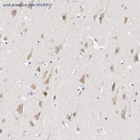 HUABIO ET7106-67 image 2