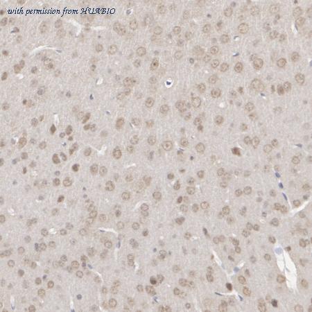 HUABIO ET7106-67 image 3