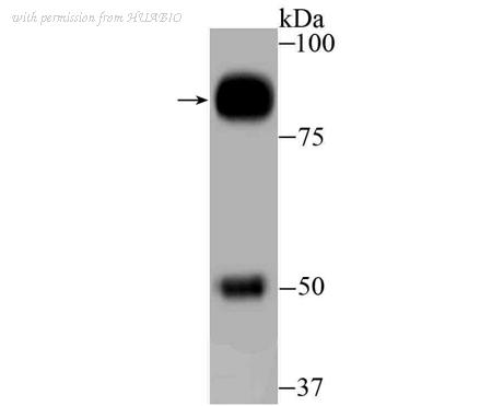 HUABIO ET7106-70 image 1
