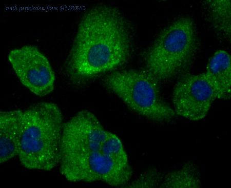 HUABIO ET7106-71 image 3