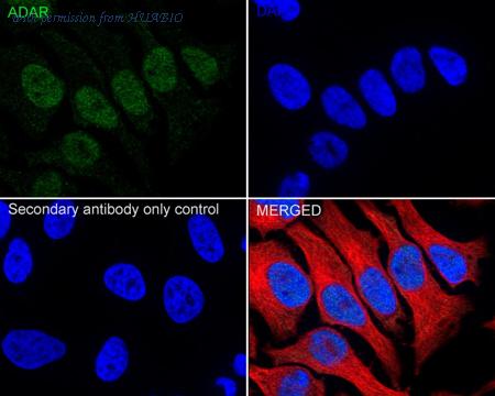 HUABIO ET7106-72 image 2